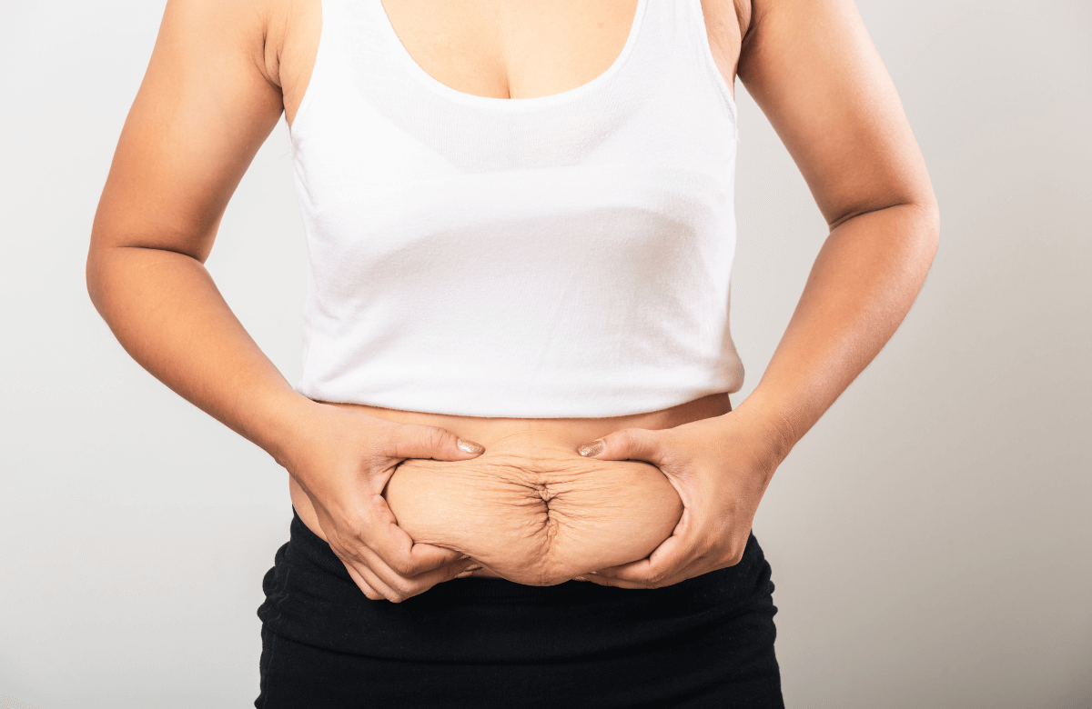 How To Avoid Loose Skin After Weight Loss Boxlife