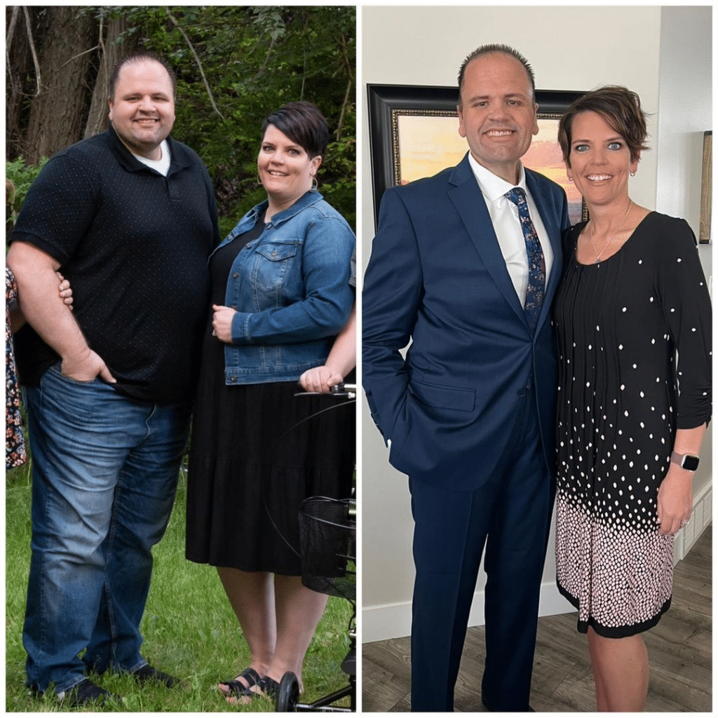 Before And After Weight Loss What You Need To Know