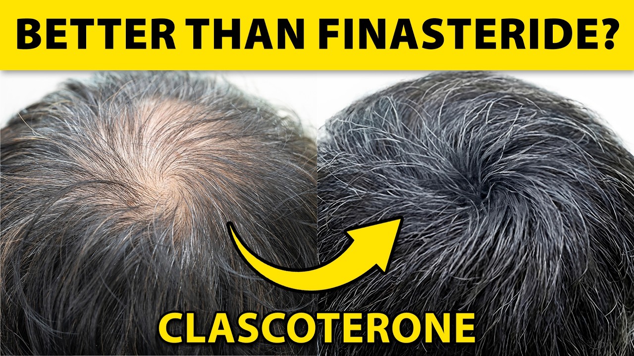 Clascoterone for Androgenetic Alopecia: From Mechanism to Phase 3 Trials