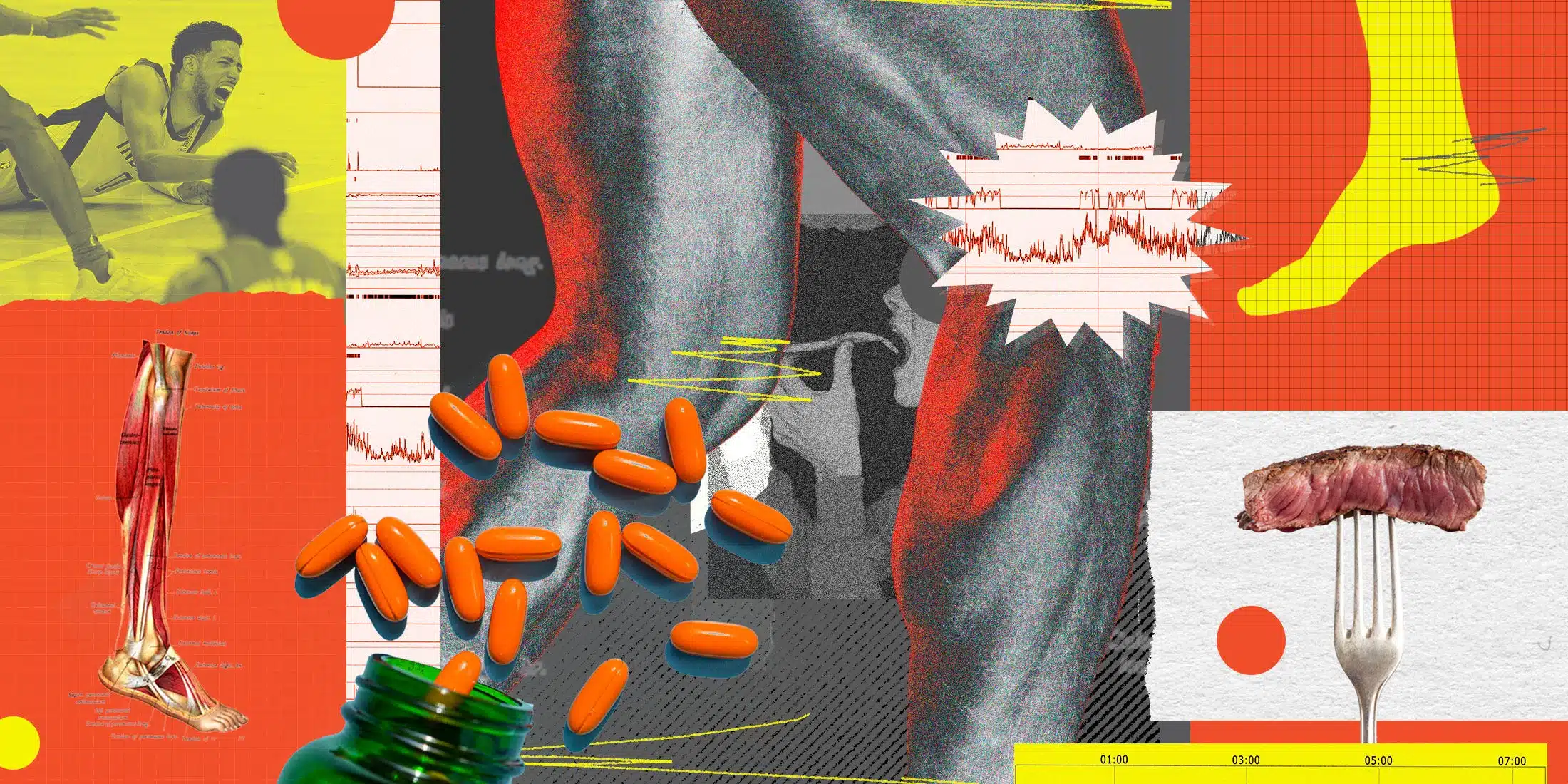 achilles-tendon-tears-risk-linked-to-diet-nutrients