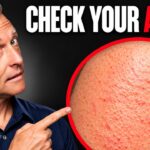 hidden-vitamin-a-deficiency-symptoms