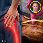 disc-problem-reveals-sciatica-root-cause