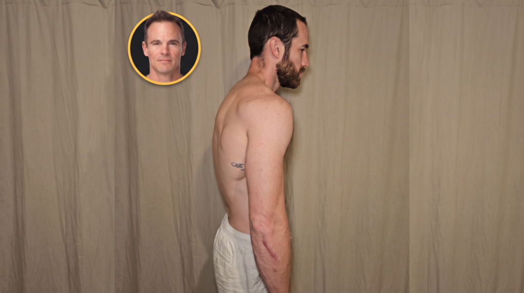Pull-Ups and Dips Are Rounding Your Shoulders Forward. Here's the Missing Movement Pattern That Fixes It