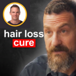 low-dose-finasteride-blocks-hair-loss