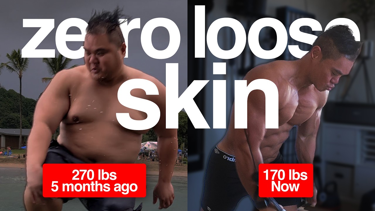 without-loose-skin-after-hundred-pound-weight-loss